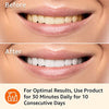 Amazon Basics 10 Day Teeth Whitening Strips Kit, 20 Count (Previously Solimo)