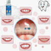 Fake Teeth Repair Kit, Provisional Fake Teeth Replacement Kit for Provisional Restoration ?100% New 30Ml -1 Bottle?