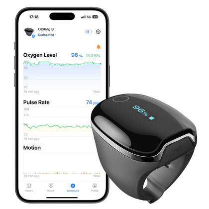 Wellue O2Ring-S Oxygen Monitor with Vibration Reminder, Bluetooth Pulse Oximeter Tracks SPO2 and Pulse Rate, 24 hrs Battery Life, 4*10 Hours Built-in Memory, Rechargeable Pulse Ox with Free PC & APP