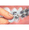 Genuine Orthowax - Orthodontic Wax for Braces Wearer - Stick Better Than competitors