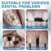 Tooth Repair Kit, Temporary Filling Tooth Kit, Dental Care Kit for Fixing Missing & Broken Teeth, Regain Confidence Smile