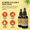 J.CROW'S® Lugol's Solution of Iodine 2% 2oz