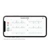 KardiaMobile 6-Lead Personal EKG Monitor - Six Views of The Heart - Detects AFib and Irregular Arrhythmias - Instant Results in 30 Seconds - Works with Most Smartphones - FSA/HSA Eligible
