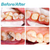 Tooth Repair Kit DIY Denture for Filling Crowns & Bridges, Instant Fixing Teeth Material for Improving Smile