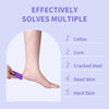 NOVAL Pumice Stone for Feet Scrubber Dead Skin Disposable Foot Pumice Foot Callus Remover Pedicure Tools Purple Pumice Sponge Nail Salon Home Use,40 PCS