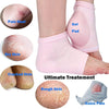 Codream Vented Moisturizing Socks Lotion Gel for Dry Cracked Heels, Spa Gel Socks Humectant Moisturizer Heel Balm Foot Treatment Care Heel Softener Compression (2 Pairs)