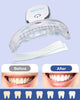 MySmile Teeth Whitening Kit with led Light, 28X Teeth Whitening Strips for Teeth Sensitive, 10 Min Fast Whitening Teeth, Helps to Remove Stains from Coffee, Smoking, Wines(1Pcs Light + 14Sets Strips)