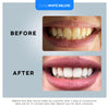 PurelyWHITE DELUXE Teeth Whitening Kit, Complete LED Teeth Whitening, 15+ Treatments, (3) 3ml Whitening Gel Syringes, Whiter Smile in 7 Minutes