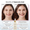 Grace & Stella Hyaluronic Acid Serum (0.34 fl oz/10 ml) Hyaluronic Acid Serum for Face - Acido Hialuronico Face Serum for Women - Hydrating Serum to Remove Fine Lines, Wrinkles - Anti Aging Serum