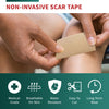 Medical-Grade Silicone Scar Tape Roll (1.6
