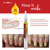 Bliss Kiss | 1 Fragrance Free | Nail Oil Cuticle Pen w/Vitamin E & Jojoba?Nail Strengthener Nail Growth Treatment for Brittle Peeling Breaking Thin Nails