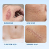 Serica Scar Gel - Silicone Scar Gel For Scar Removal - Serica Moisturizing Scar Formula - Silicone Gel For Scars - Acne Scar Treatment - Best Scar Treatment - Repair Tags - Made USA