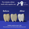 GuruNanda Teeth Whitening Strips - 7 Treatments with 14 Strips - Professional, Enamel-Safe Strips for Sensitive Teeth - Non-Slip, Dry Strip Technology