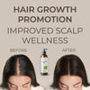 velona Castor Oil with Rosemary Oil - 8 oz | Hair Growth Oil | Hair, Scalp, Eyelashes, Eyebrows | 100% Natural and Pure