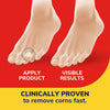 Dr. Scholl's Corn REMOVERS Seal & Heal Bandage with Hydrogel Technology, 6 ct // Removes Corns Fast and Provides Cushioning Protection Against Shoe Pressure and Friction for All-Day Pain Relief