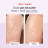 First Aid Beauty KP Bump Eraser Body Scrub Exfoliant for Keratosis Pilaris with 10% AHA - 8 oz