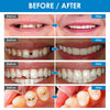 Tooth Repair Kit, DIY Tooth Replacement Kit, Denture Repair Kit Fixing The Missing and Broken Teeth, Restoring Your Confident Smile