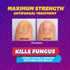 Silka Max Strength Antifungal Liquid, Toe Nail Fungus Treatment Extra Strength Liquid for Toenail Fungus, Athletes Foot Treatment, 0.45 Fl Oz
