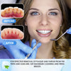 Dental Tools, Dental Pick, Plaque Remover for Teeth Cleaning Tools, Dental Picks for Teeth Cleaning Kit, Tooth Cleaner, Tartar Remover for Teeth - Dentist Kit