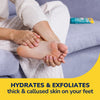 Dr. Scholl's Dry, Flaky Skin Remover Ultra Exfoliating Foot Lotion with Urea for Rough Dry Cracked Feet, Heal and Moisturize for Healthy Looking Feet, Intensive Foot Care, Alpha Hydroxy Acids, 3.5 oz