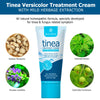Roycederm Tinea Versicolor Cream, Athletes Foot Cream, Ringworm Treatment for Humans, for Tinea Versicolor & Pedis - Multi-Functional