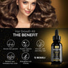 Hair Growth Serum, 5% Minoxidil & Biotin for Hair Growth for Women & Men, Hair Loss Treatments, Hair Regrowth Treatment for Thicker Longer Fuller Hair, 30ml