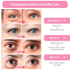 BREYLEE Rose Eye Mask - 60 Pcs Under Eye Treatment for Puffy Eyes, Wrinkles, Dark Circles and Fine Lines (Rose)