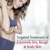 Eucerin Roughness Relief Spot Treatment, Body Moisturizer for Dry Skin, 2.5 Oz Tube